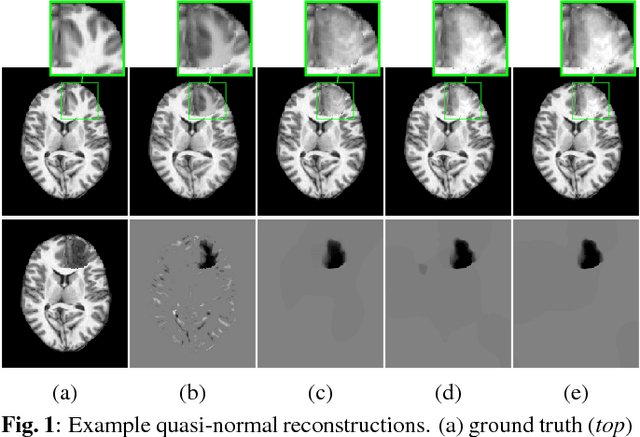Figure 1 for Efficient Registration of Pathological Images: A Joint PCA/Image-Reconstruction Approach
