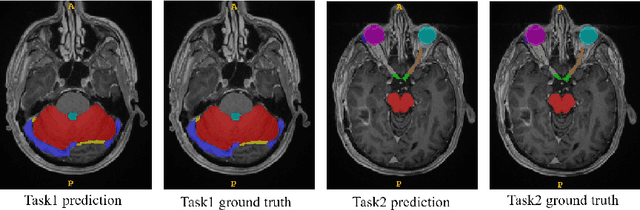 Figure 3 for Ensembled ResUnet for Anatomical Brain Barriers Segmentation