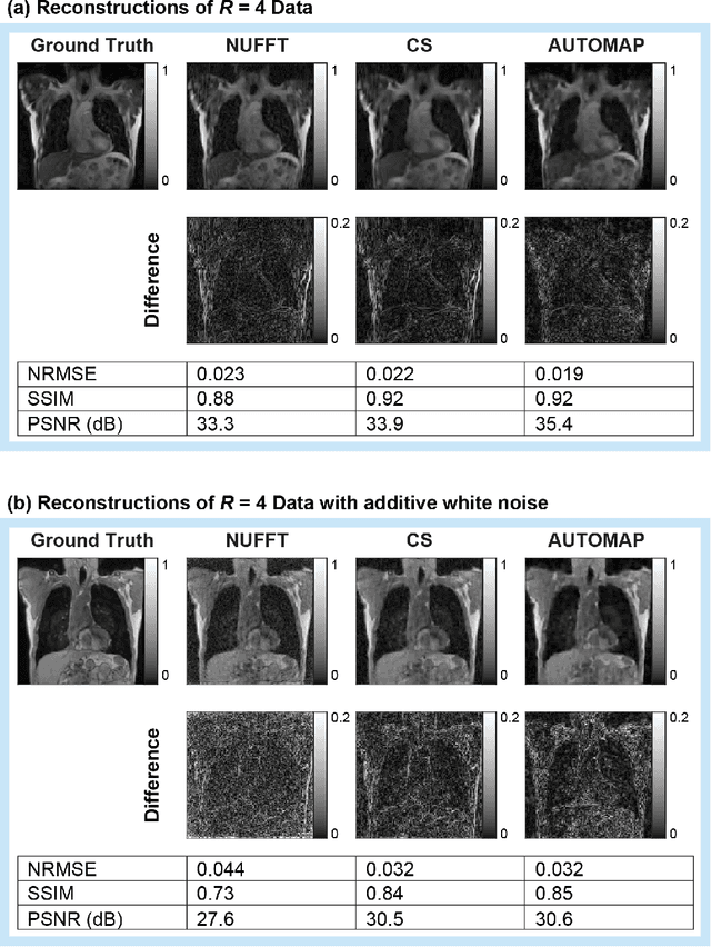 Figure 4 for On Real-time Image Reconstruction with Neural Networks for MRI-guided Radiotherapy