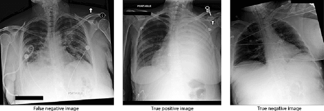 Figure 2 for Few-Shot Transfer Learning to improve Chest X-Ray pathology detection using limited triplets