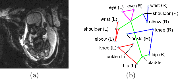 Figure 1 for Fetal Pose Estimation in Volumetric MRI using a 3D Convolution Neural Network
