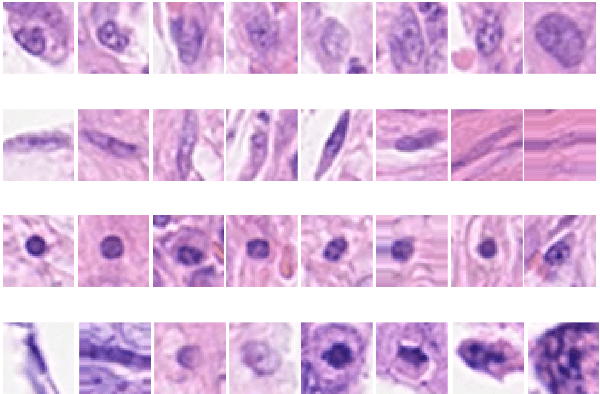 Figure 1 for Cell nuclei classification in histopathological images using hybrid OLConvNet
