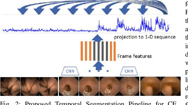Figure 2 for Unsupervised Shot Boundary Detection for Temporal Segmentation of Long Capsule Endoscopy Videos