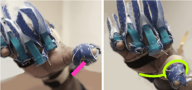 Figure 4 for Thumb Assistance Via Active and Passive Exotendons in a Robotic Hand Orthosis for Stroke