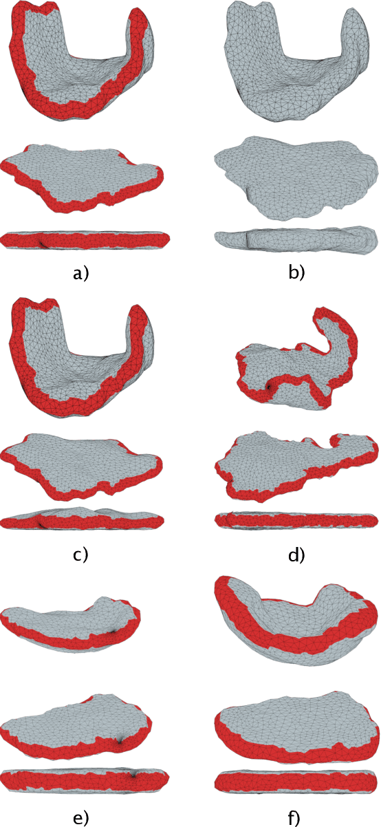 Figure 4 for Volumetric Parameterization of the Placenta to a Flattened Template