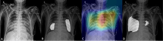 Figure 1 for Role of Edge Device and Cloud Machine Learning in Point-of-Care Solutions Using Imaging Diagnostics for Population Screening