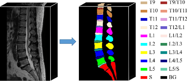 Figure 1 for Semi-Supervised Hybrid Spine Network for Segmentation of Spine MR Images