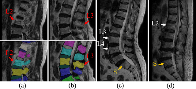 Figure 2 for Semi-Supervised Hybrid Spine Network for Segmentation of Spine MR Images