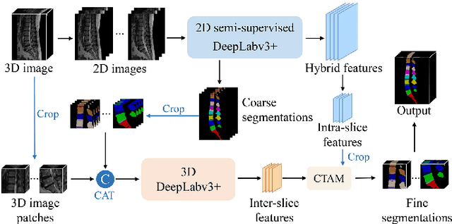 Figure 3 for Semi-Supervised Hybrid Spine Network for Segmentation of Spine MR Images