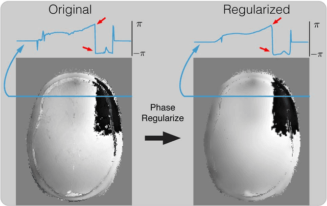 Figure 3 for General Phase Regularized Reconstruction using Phase Cycling
