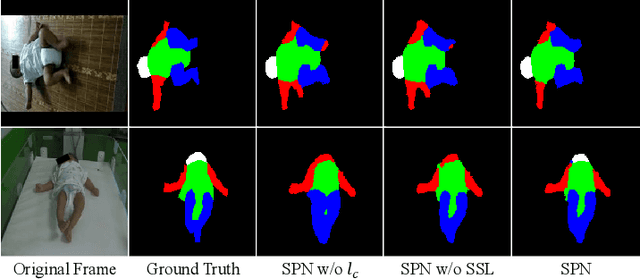 Figure 4 for SiamParseNet: Joint Body Parsing and Label Propagation in Infant Movement Videos