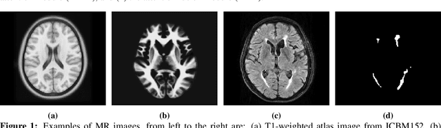 Figure 1 for Brain Atlas Guided Attention U-Net for White Matter Hyperintensity Segmentation