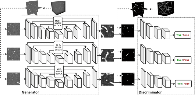 Figure 2 for MLP-GAN for Brain Vessel Image Segmentation