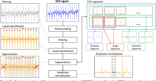 Figure 1 for ECG Biometric Recognition: Review, System Proposal, and Benchmark Evaluation