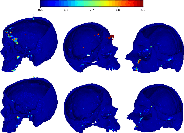 Figure 1 for Segmentation of Defective Skulls from CT Data for Tissue Modelling