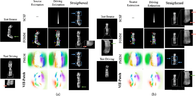 Figure 2 for A Robust Framework of Chromosome Straightening with ViT-Patch GAN