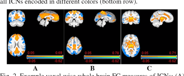 Figure 2 for Brain Age Prediction Based on Resting-State Functional Connectivity Patterns Using Convolutional Neural Networks