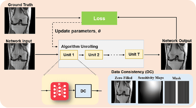 Figure 3 for Physics-Driven Deep Learning for Computational Magnetic Resonance Imaging