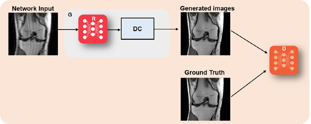 Figure 2 for Physics-Driven Deep Learning for Computational Magnetic Resonance Imaging