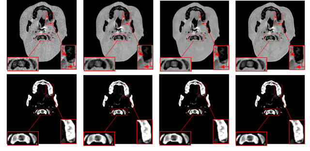 Figure 2 for DECT-MULTRA: Dual-Energy CT Image Decomposition With Learned Mixed Material Models and Efficient Clustering