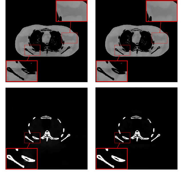 Figure 1 for DECT-MULTRA: Dual-Energy CT Image Decomposition With Learned Mixed Material Models and Efficient Clustering