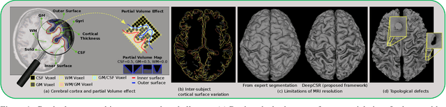 Figure 1 for DeepCSR: A 3D Deep Learning Approach for Cortical Surface Reconstruction