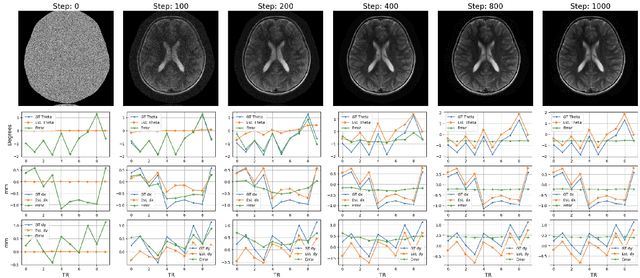 Figure 2 for Accelerated Motion Correction for MRI using Score-Based Generative Models