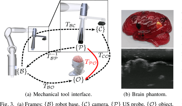 Figure 3 for Towards Safe and Collaborative Robotic Ultrasound Tissue Scanning in Neurosurgery