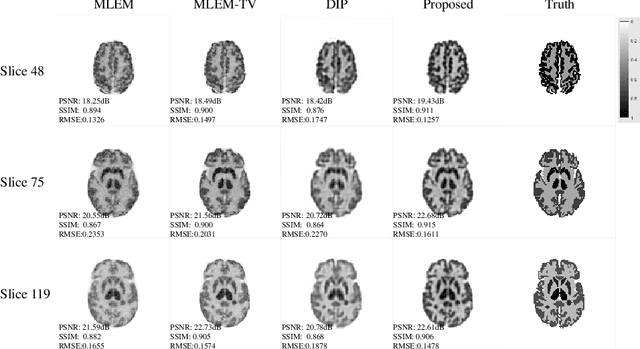 Figure 3 for DULDA: Dual-domain Unsupervised Learned Descent Algorithm for PET image reconstruction