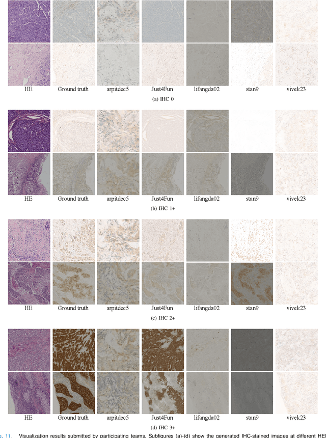 Figure 3 for Breast Cancer Immunohistochemical Image Generation: a Benchmark Dataset and Challenge Review