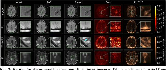 Figure 3 for PixCUE: Joint Uncertainty Estimation and Image Reconstruction in MRI using Deep Pixel Classification
