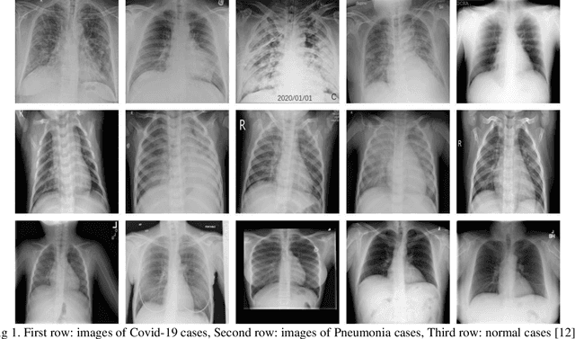 Figure 1 for Evolving Tsukamoto Neuro Fuzzy Model for Multiclass Covid 19 Classification with Chest X Ray Images