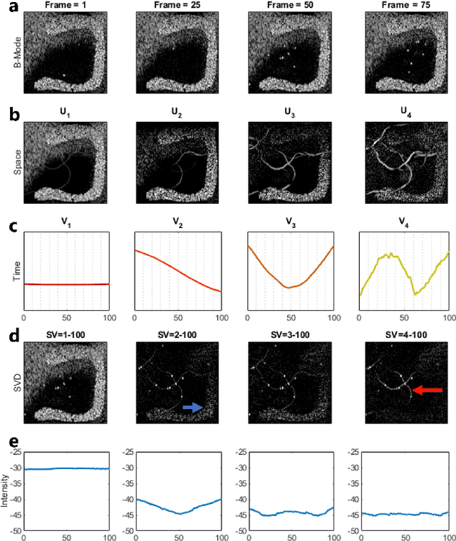 Figure 2 for On the Use of Singular Value Decomposition as a Clutter Filter for Ultrasound Flow Imaging