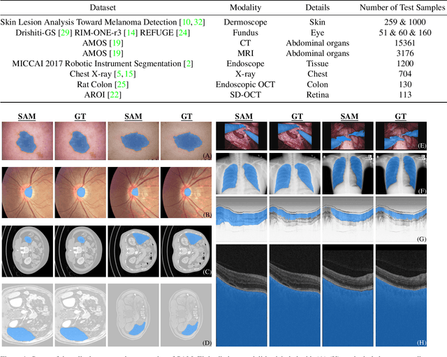 Figure 1 for Generalist Vision Foundation Models for Medical Imaging: A Case Study of Segment Anything Model on Zero-Shot Medical Segmentation