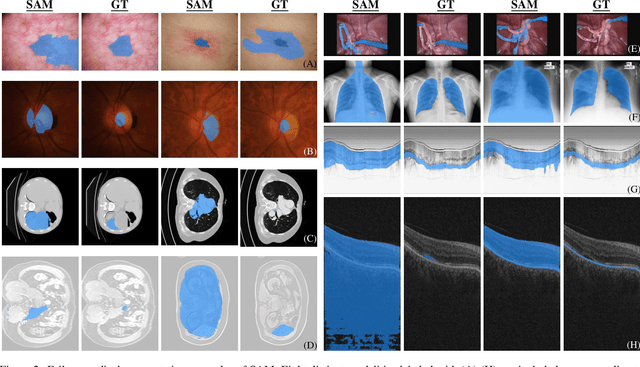 Figure 2 for Generalist Vision Foundation Models for Medical Imaging: A Case Study of Segment Anything Model on Zero-Shot Medical Segmentation