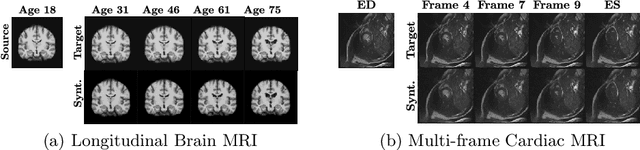Figure 1 for SADM: Sequence-Aware Diffusion Model for Longitudinal Medical Image Generation