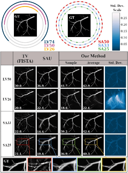 Figure 3 for Score-Based Diffusion Models for Photoacoustic Tomography Image Reconstruction
