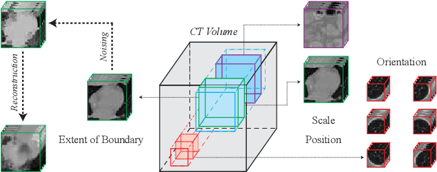 Figure 1 for A Point in the Right Direction: Vector Prediction for Spatially-aware Self-supervised Volumetric Representation Learning