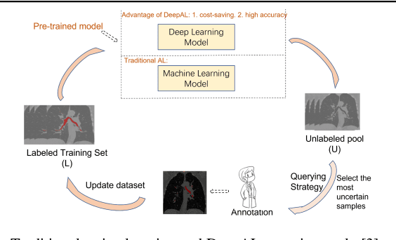 Figure 1 for High Accuracy and Cost-Saving Active Learning 3D WD-UNet for Airway Segmentation