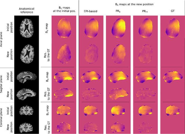 Figure 2 for Predicting dynamic, motion-related changes in B0 field in the brain at a 7 T MRI using a subject-specific fine-tuned U-net