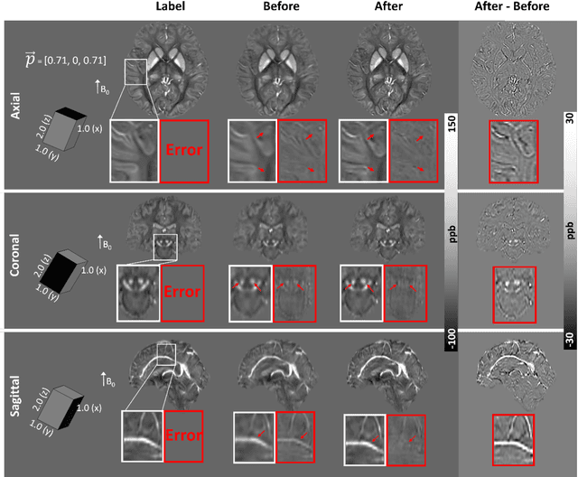 Figure 2 for Affine Transformation Edited and Refined Deep Neural Network for Quantitative Susceptibility Mapping
