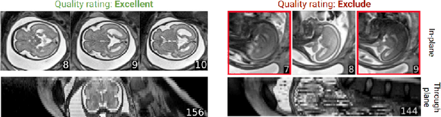 Figure 1 for FetMRQC: Automated Quality Control for fetal brain MRI