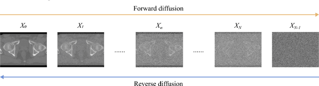 Figure 1 for Synthetic CT Generation from MRI using 3D Transformer-based Denoising Diffusion Model