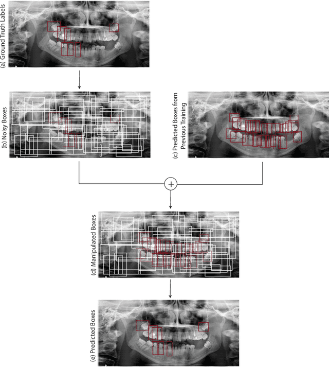 Figure 2 for Diffusion-Based Hierarchical Multi-Label Object Detection to Analyze Panoramic Dental X-rays