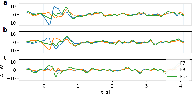 Figure 2 for Latent Alignment with Deep Set EEG Decoders