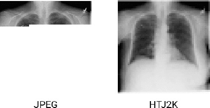 Figure 1 for High-Throughput AI Inference for Medical Image Classification and Segmentation using Intelligent Streaming