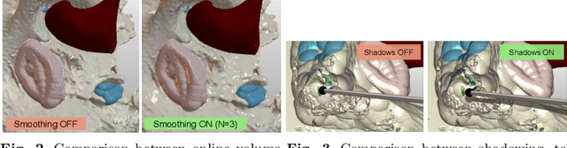 Figure 2 for Fully Immersive Virtual Reality for Skull-base Surgery: Surgical Training and Beyond