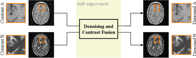 Figure 1 for Noise2Contrast: Multi-Contrast Fusion Enables Self-Supervised Tomographic Image Denoising