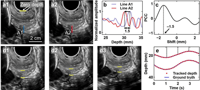 Figure 4 for Quantification of cervical elasticity during pregnancy based on transvaginal ultrasound imaging and stress measurement