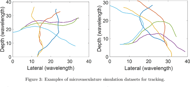 Figure 3 for Acceleration-Based Kalman Tracking for Super-Resolution Ultrasound Imaging in vivo
